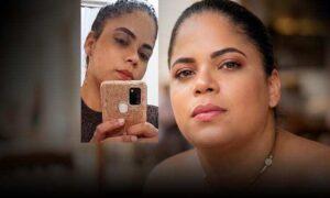 Tragédia: Mulher de 25 anos morre atacada pelo próprio pitbull no quintal de casa. “Tratava ele como filho”